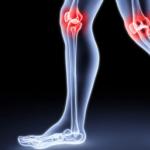 Причины и лечение отека коленного сустава