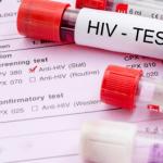 HIV は現代の「疫病」です。それは治療可能ですか?
