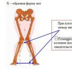 脚の内反変形について、マッサージ、ゲームに役立つポーズ子供の形をした脚についてのマッサージ