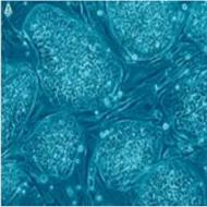 幹細胞治療: 特徴と有効性 幹細胞治療の結果