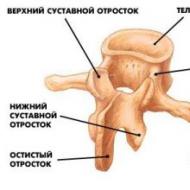 子宮頸椎脱臼：原因、症状および治療