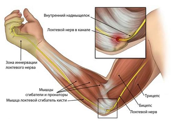 kórtörténet a vállízület artrózisa