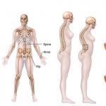 Tünetek és csontritkulás kezelése
