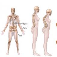 Semptomlar ve osteoporoz tedavisi