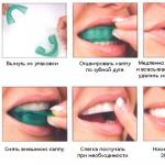 歯のホワイトニングの代替方法 活性剤または炭