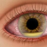ポルダン-点眼薬の説明