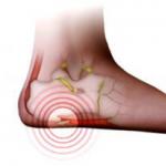 ऊँची एड़ी के जूते पर चलना: बिल्ड-अप की एक तस्वीर, लक्षण और इसकी उपस्थिति के कारण