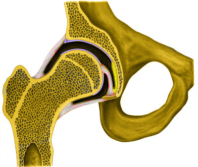 a bal csípőízület osteochondropathia kezelése