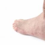 पैर का पक्षाघात फिजियोथेरेपी अभ्यास पैर के पैर पर चोट को ठीक करने में कितना समय लगता है