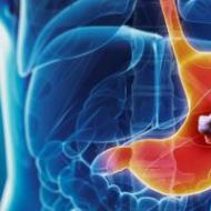 胃がん - 非伝統的な方法による治療
