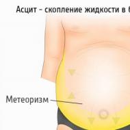 腹部腹水：原因、治療、予後腹部腔外傷超音波の体液