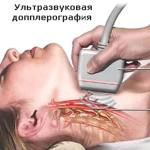 小児の頭頸部の血管の超音波検査 小児の頭頸部の血管のドップラー検査