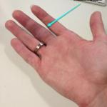 Részletek egy ujjal való megtörésről a kézen vagy lábon