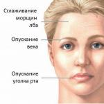 顔面神経の神経痛と病気の治療法