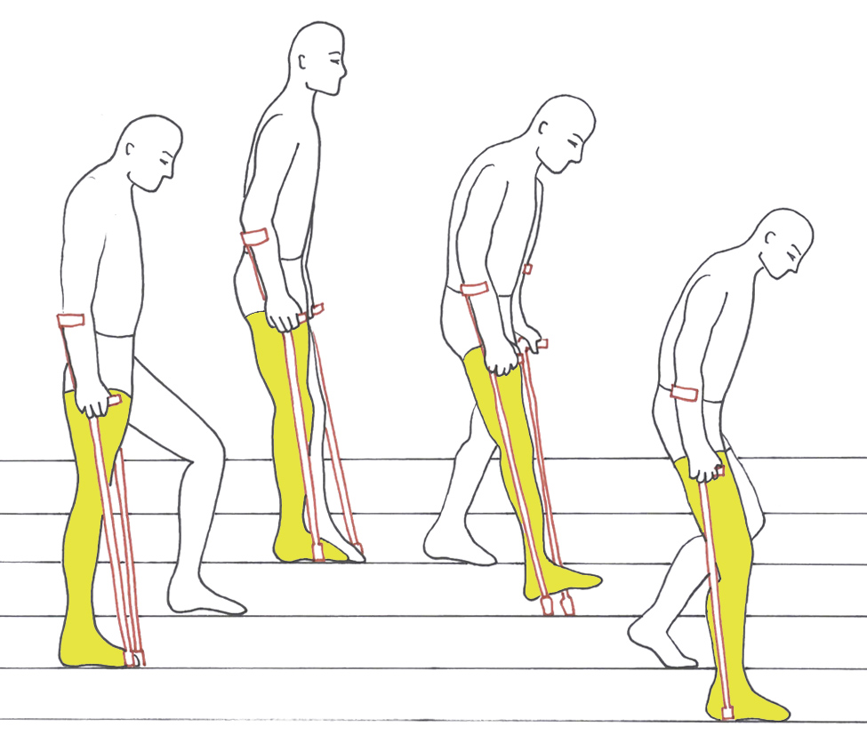Гимнастика после операции на коленном суставе